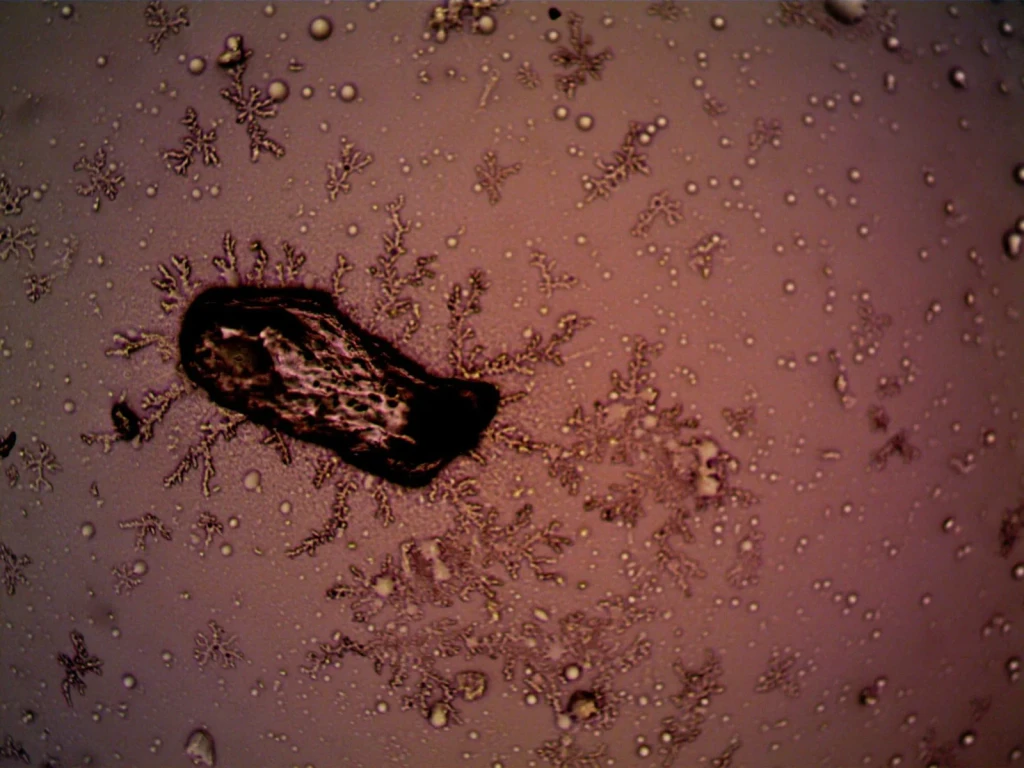 Bacteria and Crystals, from Look Closer: A Microscopy Exhibition