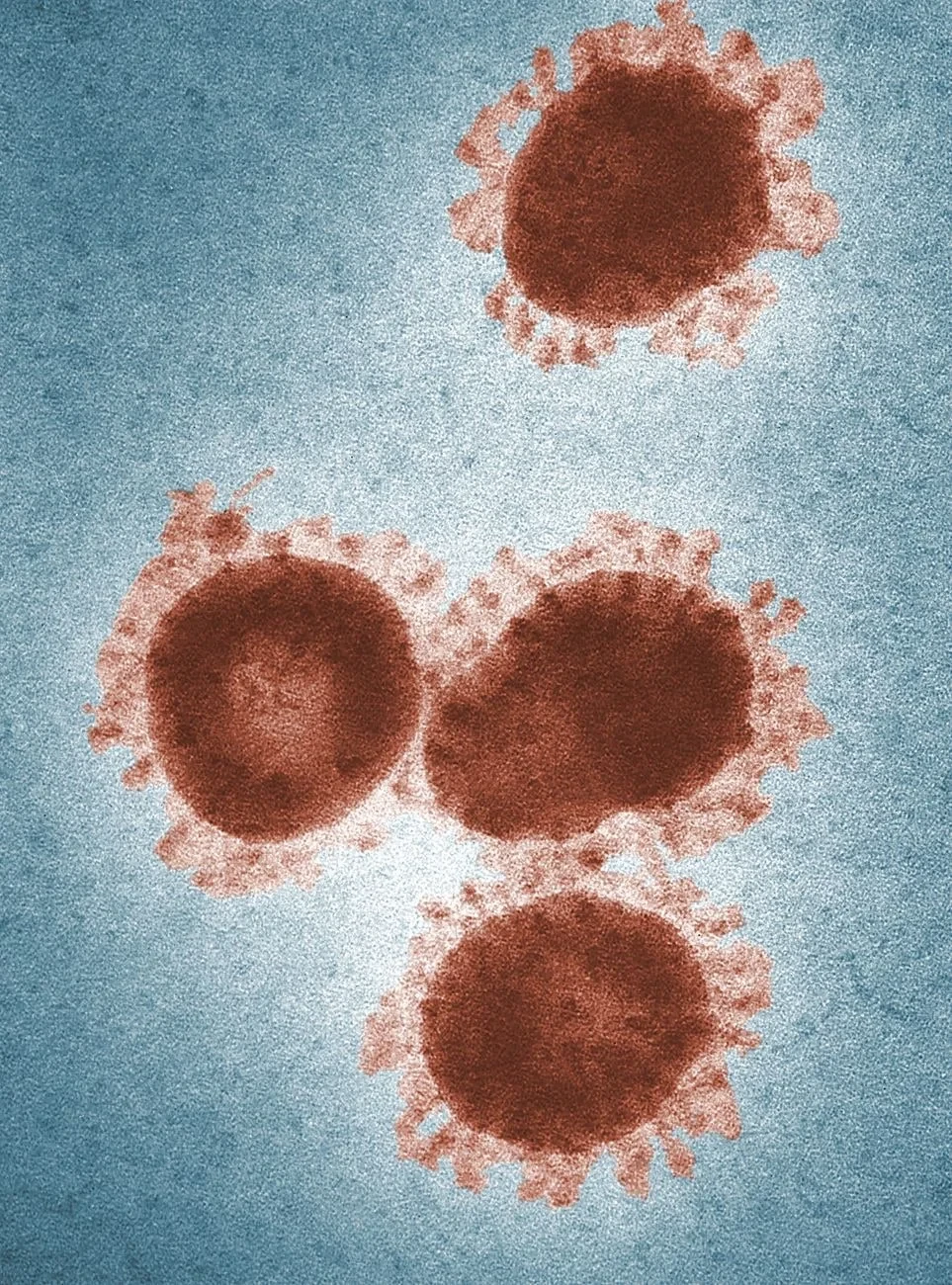 Spike Proteins, from Look Closer: A Microscopy Exhibition