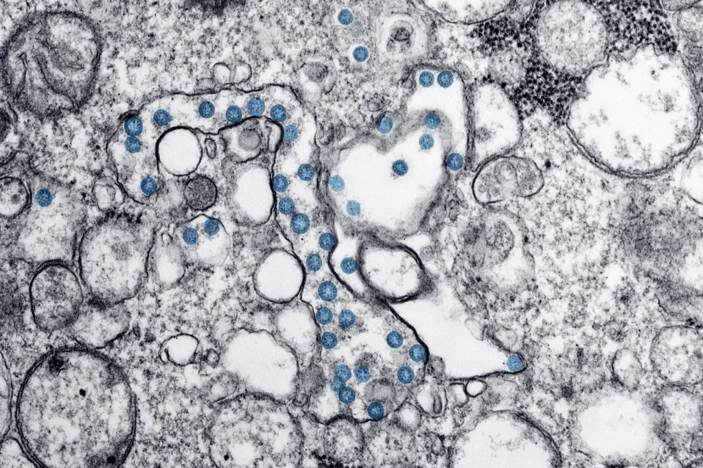 Abstract Microscopic Forms, from Look Closer: A Microscopy Exhibition